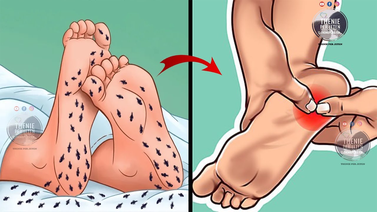 Ju ziejnë dhe ju kruhen këmbët? Ja çfarë tregon kjo për shëndetin tuaj