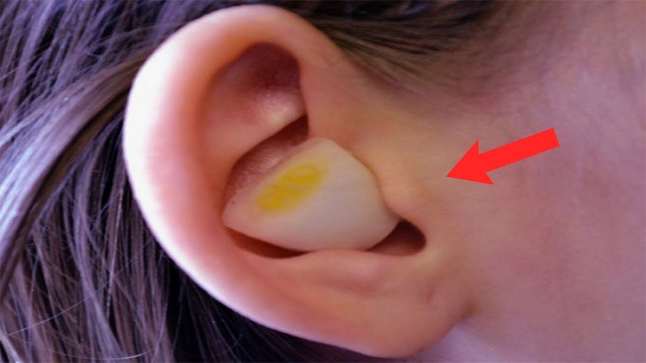 Një mrekulli e vërtetë/ Merr një thelpi hudhër, vendose në vesh dhe prit 30 minuta