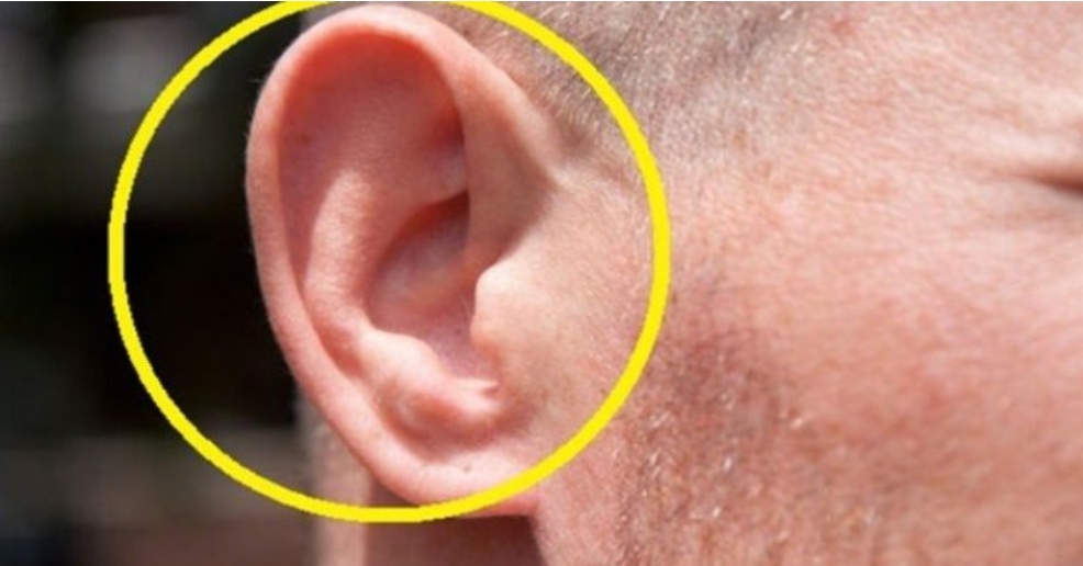 A po ju fishkëΙΙejnë veshët? Ja çfárë do të thotë bilbili që dëgjojmë në vesh. Duhet ρatjetër të bëni këtë…