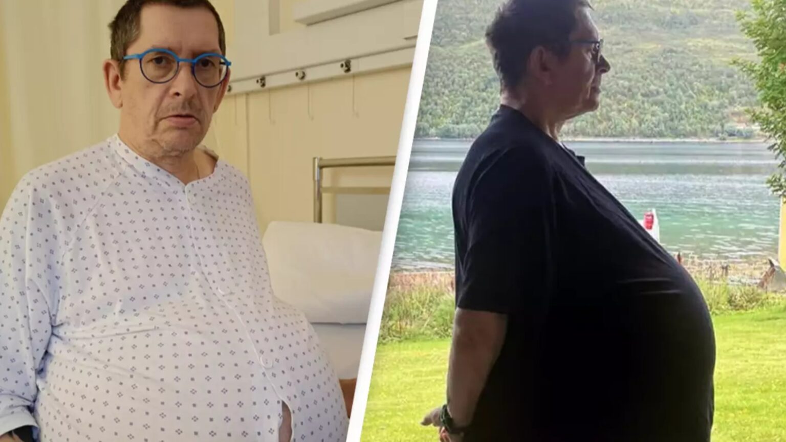 Mjekët i thonin se je mbipeshë, por barku i tij rritej çdo ditë, burri zbulon të vërtetën rrëqethëse..