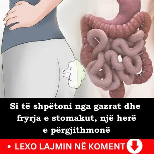 Si të shpëtoni nga gazrat dhe fryrja e stomakut, një herë e përgjithmonë