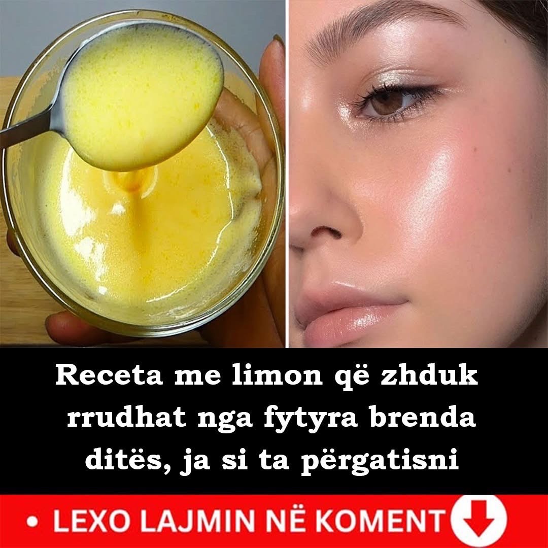 Maska që zhduk rrudhat për 1 ditë, kjo recetë me limon do ju lërë pa fjalë