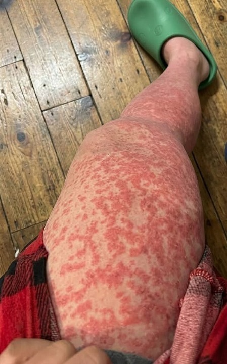 These are the consequences of sleeping with a…//