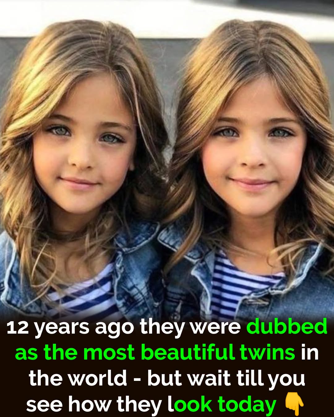 They called them the world’s most beautiful twins 10 years ago – but now look what the girls look like today