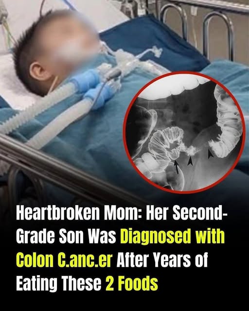 A Mothers Heartbreak Child Diagnosed with Colon Cancer After Years of Unhealthy Eating Habits